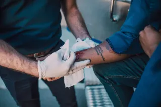 Photo Of An Arm With Wound