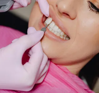 Detailed shot of a dentist applying veneer to a woman's teeth during a dental procedure.